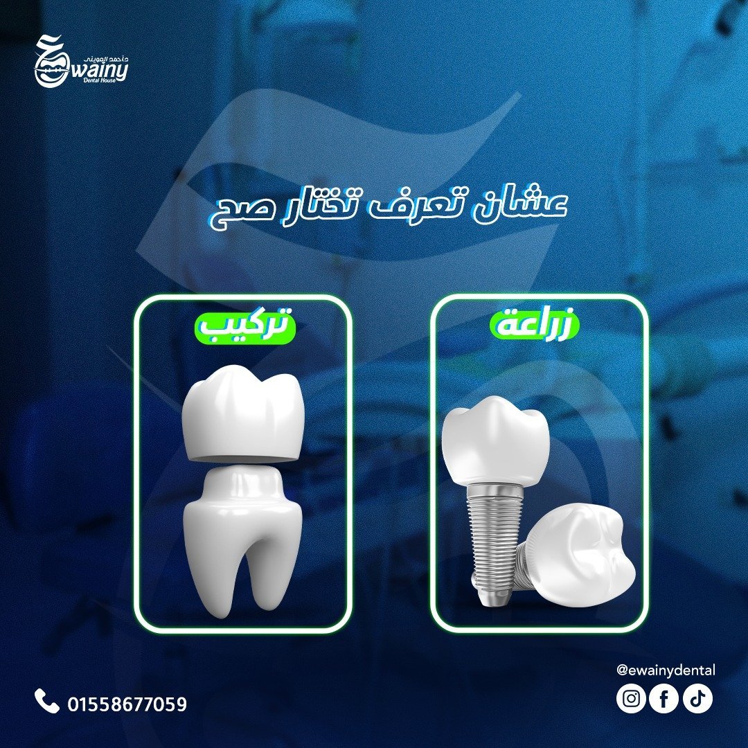 عيادة العويني لطب الأسنان - د. أحمد العويني — 15