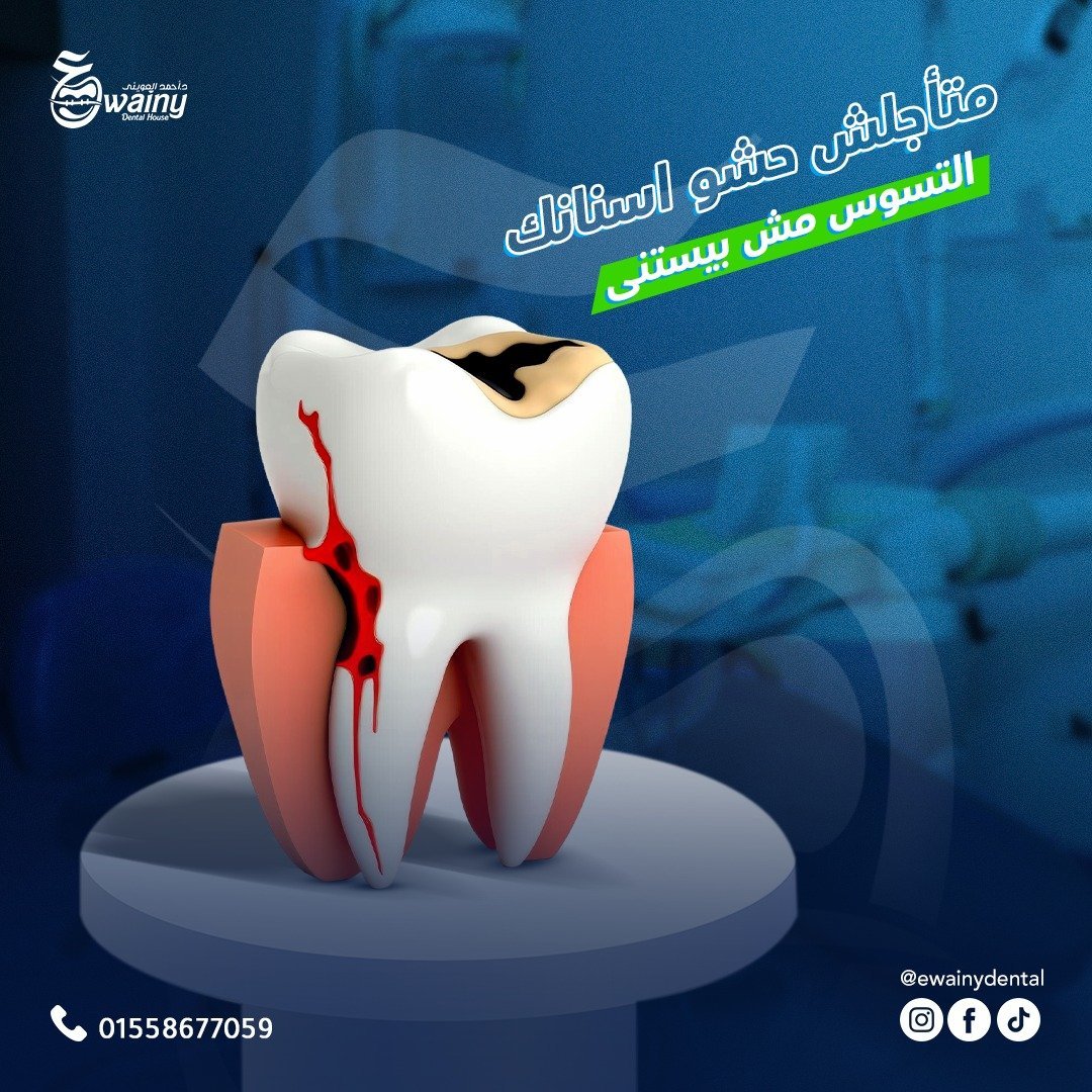 عيادة العويني لطب الأسنان - د. أحمد العويني — 7